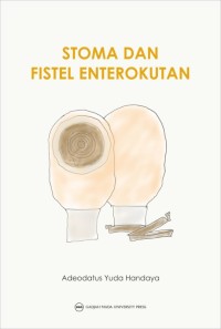 Image of Stoma dan Fistel Enterokutan